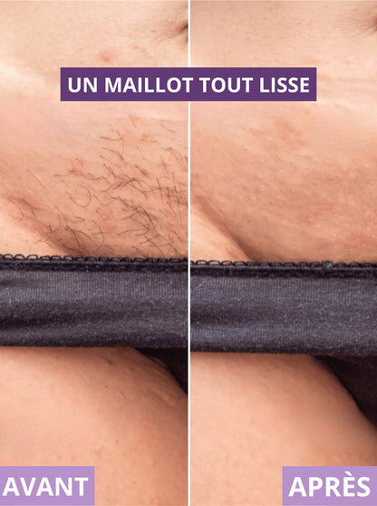 RASOIR 2 EN 1 - ZÉRO POILS INCARNÉS - Névea